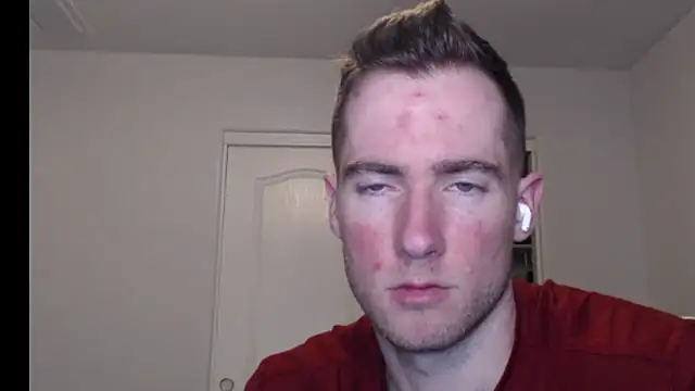 Snapshot of rawdawgrex chatting on 7, 3, 2026 rawdawgrex online show from 7, 3, 2026